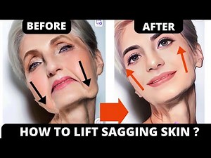 No Surgery, No Fillers: Natural Face Exercises to Lift Jowls & Smooth Laugh Lines! | 13 min
