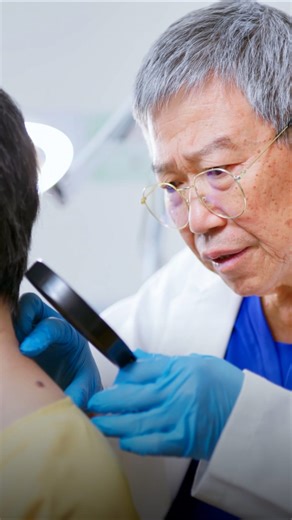 Mole checking: How to spot signs of skin cancer