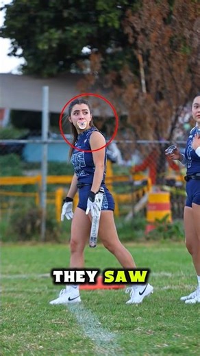 Wearing Pacifier During Match