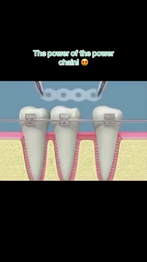Bietsch Orthodontics on TikTok
