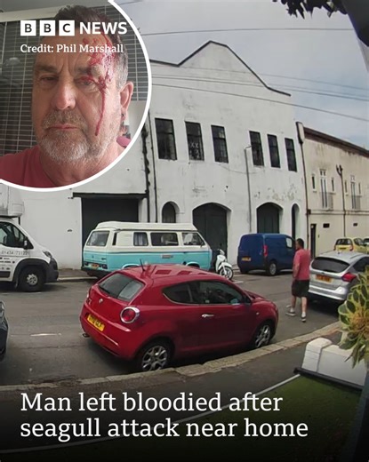 476K views · 160 reactions | A man was left bloodied after being attacked by a seagull as he walked out of his partner's home. Tap to read more: https://bbc.in/3ZP0XQA | BBC Sussex | Facebook