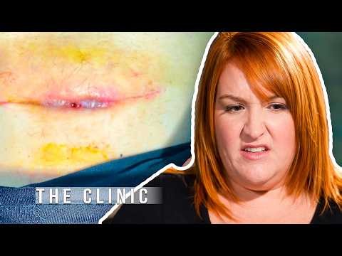 A Painful C-Section Scar Leaves Doctors Concerned