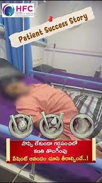 నొప్పి లేకుండా గర్భసంచిలో కణతి తొలగింపు || Painless Polyp Removal With Hysteroscopy || HFC