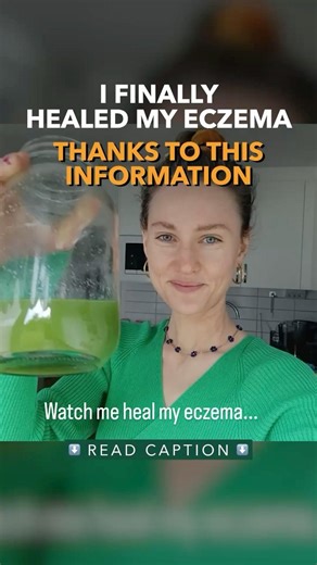 I Finally Healed My Eczema Thanks To This Information