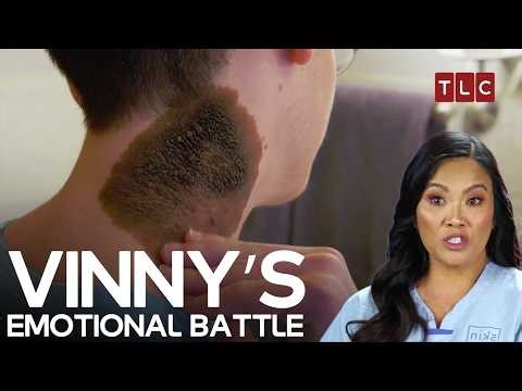 Vinny’s Birthmark Becomes His Biggest Battle | Dr Pimple Popper S2 E8 | TLC India