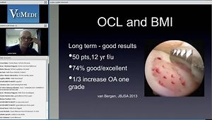 Ankle Osteochondral Lesions Treatment Overview