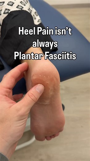 Paul Macaulay | Podiatrist 👣 | Singapore 🇸🇬 on Instagram: "Heel pain isn’t one diagnosis. And treating it like it is often keeps people stuck. In clinic, I use @clariusmhealth MSK ultrasound to look inside the heel rather than relying on symptoms alone. It allows me to clearly differentiate between:�• Plantar fasciitis�• Fat pad inflammation�• Fat pad atrophy�• Plantar fibromas�• Other soft tissue causes of heel pain That distinction matters, because each condition needs a different managemen