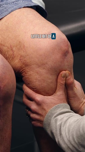 6.9K views · 15 reactions | ‍♀️ Using manual therapy with knee...