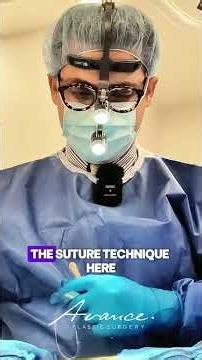 Belly Button Scar Revision | Avance Plastic Surgery Institute: Dr. Erez Dayan | Reno/Tahoe, NV