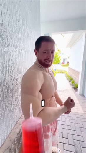 “The Biggest Injection Prank — You'll Laugh!” 🤣“#shorts