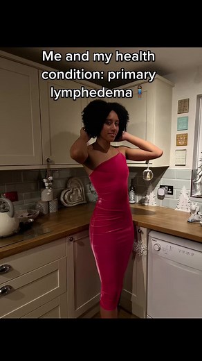 Understanding Primary Lymphedema: A Comprehensive Guide
