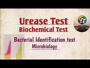urease test ll Biochemical Tests ll Bacterial Identification test ll Microbiology