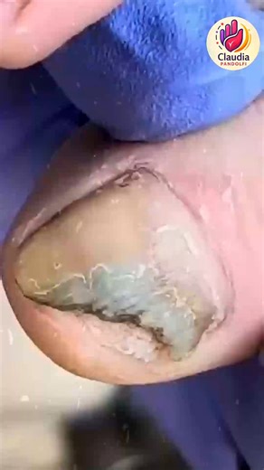 Ep.864 Music or podcast supported portion control tips 💐🎀 #CalorieControl #HeartHealthyDiet #WellnessLifestyle | Claudia Pandolfi