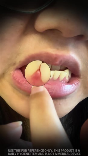 Probiotic Toothpaste for Healthier Teeth and Gums