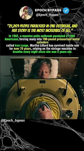 70 Years Living Inside an Iron Lung 😱 #historicalfacts