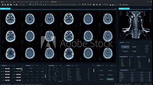 Magnetic Resonance Imaging Brain Scan Mock-up with Multiple Windows and Data. Professional Medical Research Software Template with MRI Results for Computer Displays and Laptop Screens. Stock Video