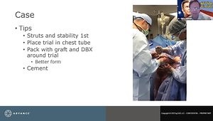 Total Elbow Arthroplasty Techniques & Tricks: A Case Based Approach