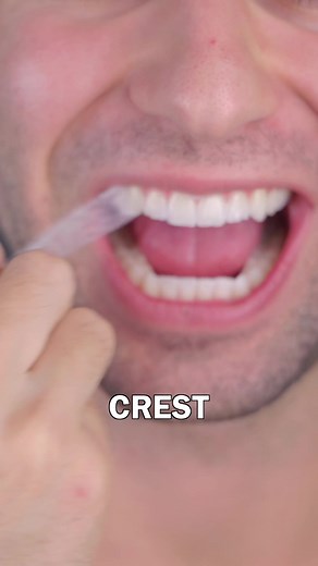 Crest Whitening Strips Review