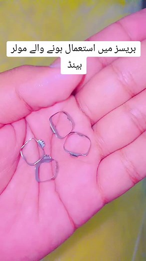 Understanding Molar Bands in Orthodontics