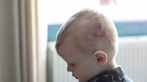 Video: Toddler's wooly hat saves his life in horrific dog attack