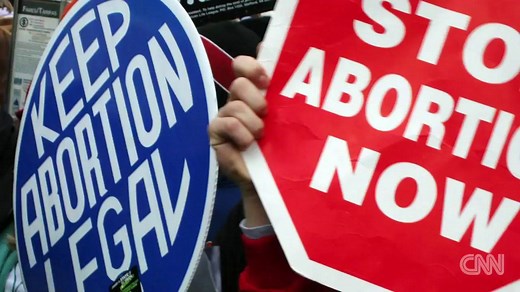 Abortion laws vary dramatically around the world -- in some countries it's a personal choice, in others it's outright illegal. http://cnn.it/2kleB8P | CNN