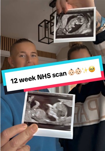 Our 12 week NHS dating scan 👶🏻👶🏻 Twins are doing well and grown so much since the last scan🥹✨#pregnancytiktok #12weekspregnant #ultrasound #fyp #twins