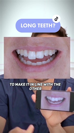 Effective Long Asymmetric Teeth Management Techniques