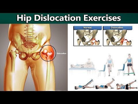7 Rehabilitation Exercises for Hip Dislocation or Dislocated Hip