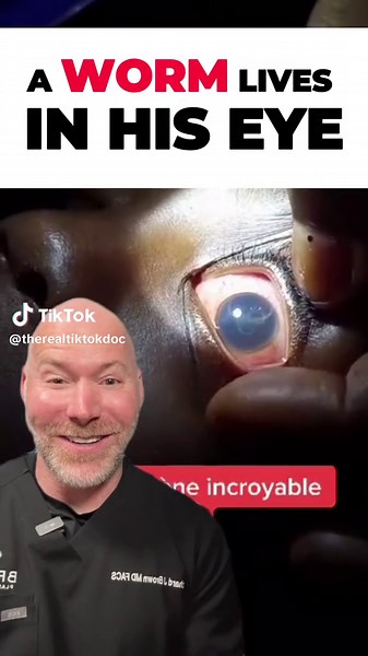 Understanding the Loa Loa Fly and Parasite Transmission: Symptoms and Prevention