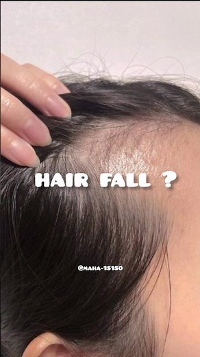 Ginger for Fast Hair Growth 🌿✨ | Natural Hair Growth Secret 💚
