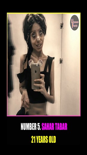 19K views · 58 reactions | Sahar Tabar Plastic Surgery #facesurgery #Iranian #edited #instagraminfluencer #AngelinaJolie #zombiegirl #plasticsurgery | Unseen Facts Compilations | Facebook