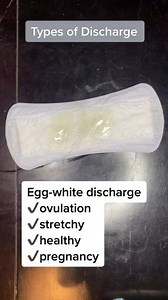Types of Discharges you should know 🤗 #discharged #normal #notnormal #learningisfun | Midwife Mhukikay