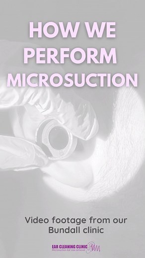 Ever wondered how microsuction ear wax removal works? 🫧 We’re renowned on the Gold Coast for the safe, gentle and efficient procedure provided by our expert registered nurses 👂🏼 See the process yourself, from waxy 🕯to clean 🧼 You can watch your own ears when visiting the clinic, our surgical microscopes are connected to a TV 📺 so watch the magic unfold 🪄 Hear better, feel better. #earcleaning | Ear Cleaning Clinic
