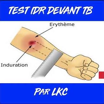 Test IDR devant Tuberculose { SUB ENG }