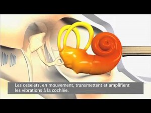 Le fonctionnement de l’audition