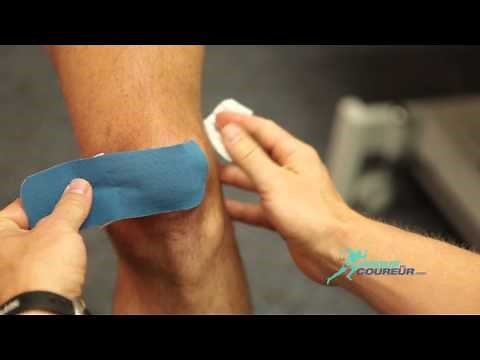 Taping genou - Syndrome fémoro-patellaire