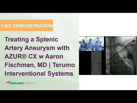 Treating a Splenic Artery Aneurysm with AZUR® CX w Aaron Fischman, MD| Terumo Interventional Systems