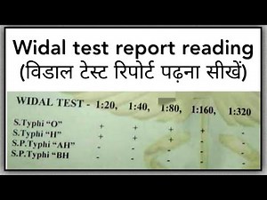 Widal test report easy reading in Hindi //विडाल टेस्ट रिपोर्ट पढ़ना सीखें हिंदी में//#widalreport