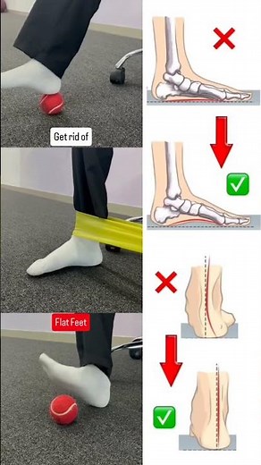 Fix Flat Feet with These Fun & Easy Exercises! 🦶😂 | FlexifyMe