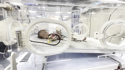 Gaza’s starving children face permanent damage from chronic hunger