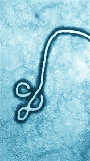 How does Ebola spread? Infectious disease expert explains