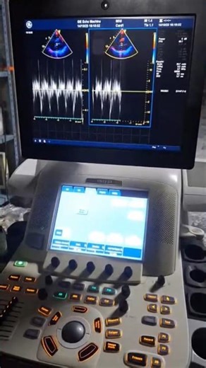 ultrasound GE vivid e9 dedicate cardiac