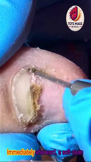 Strong Toenails: Simple upkeep for long-term wellness ♥️ #EverydayCare #WellnessSeniors #SeniorHealth | Tots Mags Wheel