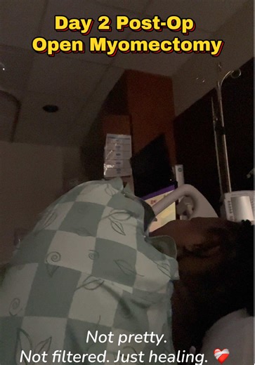 Day 2 after my open myomectomy and this is the part that people don’t show. Fibroid surgery recovery is painful, humbling, and emotional…from gas cramps to limited mobility to feeling completely vulnerable. If you’re preparing for an open myomectomy or fibroid removal surgery, I hope this gives you a realistic look at what recovery can feel like. You are not weak. You are healing. Saving this for any woman preparing for fibroid surgery 🤍#openmyomectomy #myomectomysurgery #fibroidsurgery #fibroi