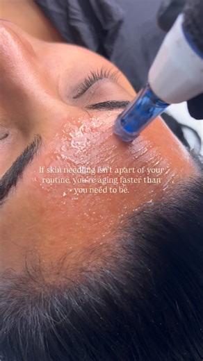 If skin needling isn’t in your routine, you’re aging faster than you need to be. Microneedling stimulates collagen and elastin which are the building blocks that keep your skin firm, smooth, and youthful. It’s not just a trend; it’s skin longevity in action. | SKIN SZN