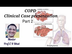 COPD Clinical case presentation - Part 2