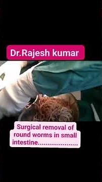 surgical removal of round worms from the small intestine.......