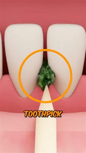 Stop Using Toothpicks! The Hidden Damage Dentists Don’t Want You Ignoring 😬