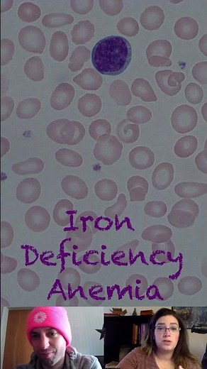 Pathophysiology of Iron Deficiency Anemia
