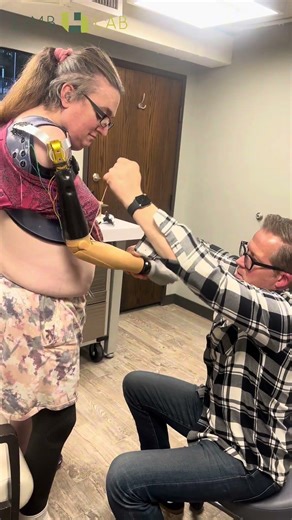 Shoulder Disarticulation Prosthesis